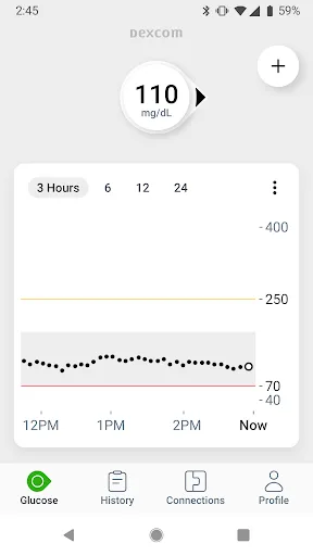 Dexcom G7 screenshot